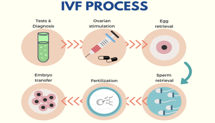 IVF-Procedure Market